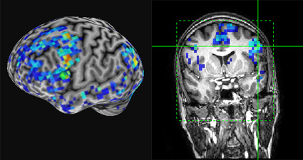 fMRI scan_cognitive testing